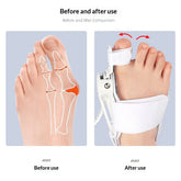 ToeRelief™ Adjustable Bunion Corrector Set