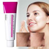 Aura Radiance Cream | Fast Dark Spot Remover, Lightweight, Hydrating