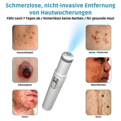 Klara™ Painless Laser Pen — Reveal Flawless Skin And Confidence Anytime