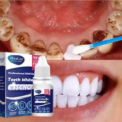 Teeth Whitening Essence Remove Plaque Stains Serum Fresh Breath Oral Hygiene Against Dental Caries Dental Tooth Cleaning 10ml