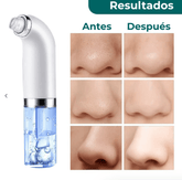 LumiPure™ — Unlock irresistibly smooth, clear skin that turns heads everywhere