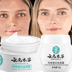 Whitening Freckle Cream Face Moisturizing Face Skin Care