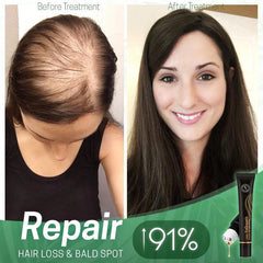 1+1 FREE | NextGrow™ Stop Hair Loss and Stimulate Growth Naturally