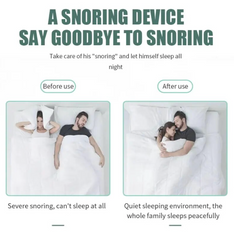 Anti-Snoring Device | 4 PCS