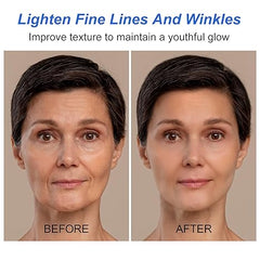 Last Day Promotion 70% OFF - Anti Aging/Botox Stock Solution 💙