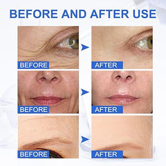 Last Day Promotion 70% OFF - Anti Aging/Botox Stock Solution 💙