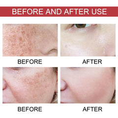 Achieve Radiant, Even-Toned Skin with Every Drop