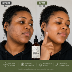 SilkAway™ Cyperus Hair Reduction Oil
