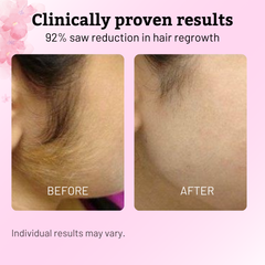 Cypress Hair Reduction Oil | Natural Blend for Smooth Skin