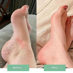 InstantRelief™ — Say Goodbye to Foot Pain and Welcome Every Step with Comfort