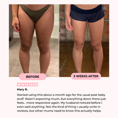 Mireva Fit Thigh Trainer | Durable, Compact Design for Strengthening and Toning