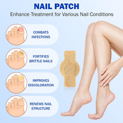 Nail Fungus Patches | Antifungal Nail Care | Overnight Repair | Nailox