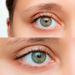 Eye Lift – 240 patches