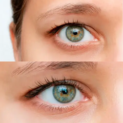 Eye Lift – 240 patches