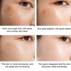Whitening Freckle Cream Face Moisturizing Face Skin Care