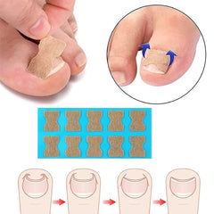 Ingrown Toenail Tools Set