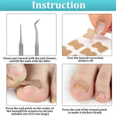 Ingrown Toenail Tools Set