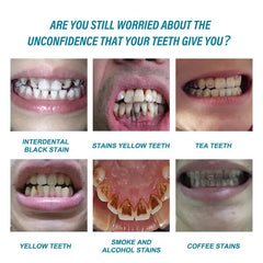 Teeth Whitening Essence Remove Plaque Stains Serum Fresh Breath Oral Hygiene Against Dental Caries Dental Tooth Cleaning 10ml