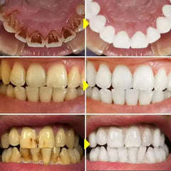 Tooth Whitening Pen Dazzling White Teeth Whitening Pen Instant Teeth Whitening Pen Brighten Your Smile Tooth Hygiene Care Tools