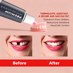 Comfort Denture Adhesives Glue Teeth Care Thermoplastic Denture Silicone Reline Kit Adhesive Cushion Friction Fixed Dentures.
