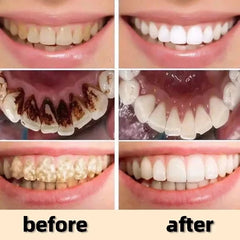 Black Powerful Teeth Whitening Powder Fast Whitens Yellow Teeth Effective Removes Stains Gently Cleans Oral Hygiene Gums Care