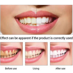 Tooth Whitening Pen Dazzling White Teeth Whitening Pen Instant Teeth Whitening Pen Brighten Your Smile Tooth Hygiene Care Tools