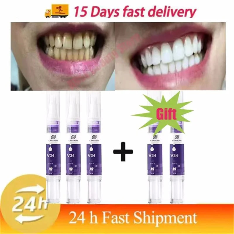 Magical Teeth Whitening Pen Effectively Removes Dental Plaque Coffee Stains Smoke Stains Freshens Breath Teeth Whitening Care
