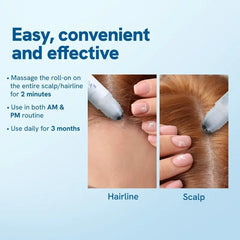 Felicity Hair Growth Serum | Powerful Follicle Activator, Precision Roller