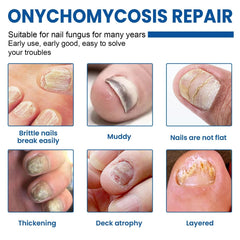 Fungal Nail Restoration Patches 60pcs