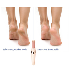 FootCare™ SmoothStep - Rechargeable Electric Callus Remover