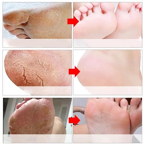 Peeling Foot Mask dylinoshop