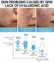 Glamour Premium Hyaluronic Acid Serum 10pcs = 150ml dylinoshop