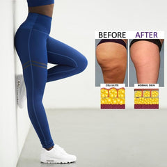 Women's Anti-cellulite Compression Leggings Zimomo