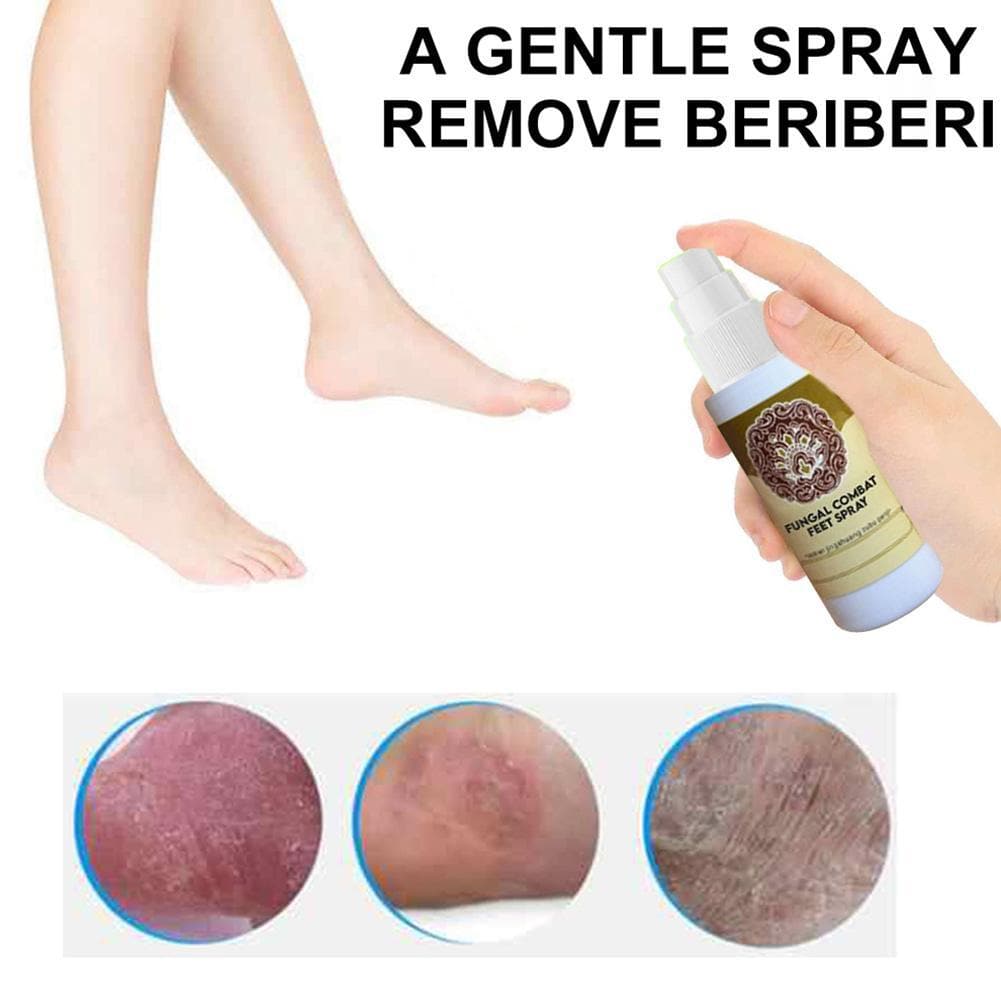 Fungal Treatment Foot Spray DYLINOSHOP