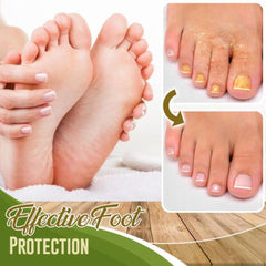 Fungal Treatment Foot Spray DYLINOSHOP