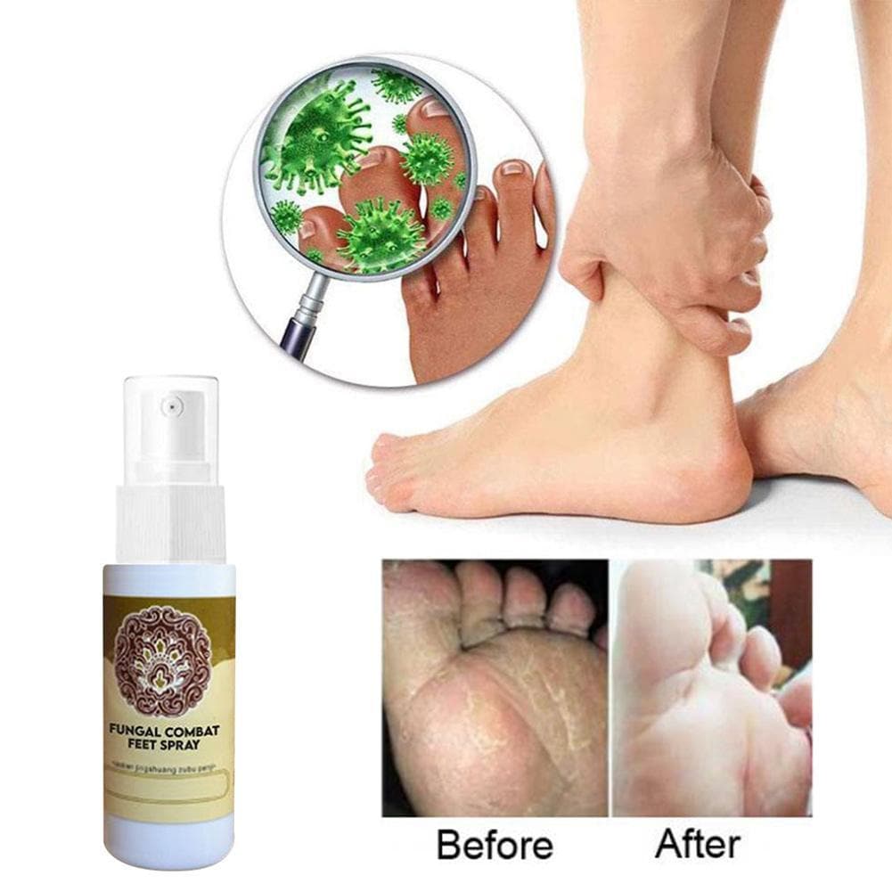 Fungal Treatment Foot Spray DYLINOSHOP