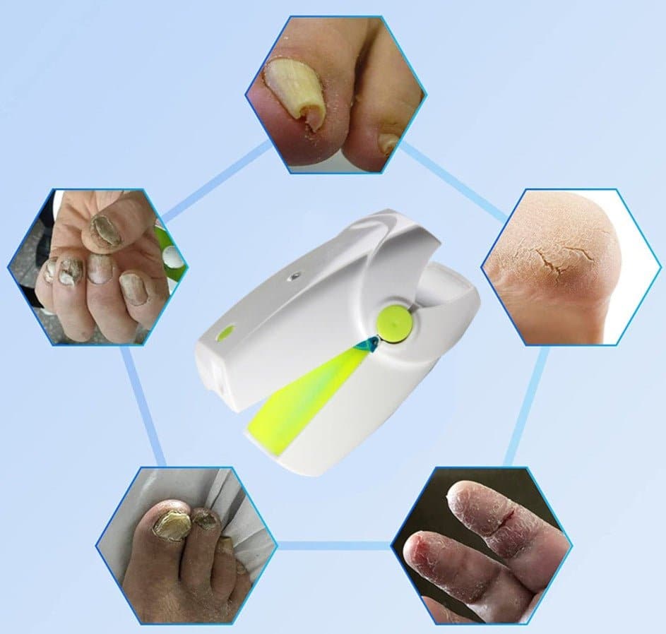 Portable Fungus Nail Laser DYLINOSHOP