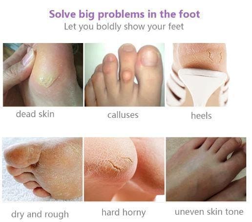 Silky Feet™ - Exfoliating Foot Masks (Buy 1, Get 2 FREE) dylinoshop